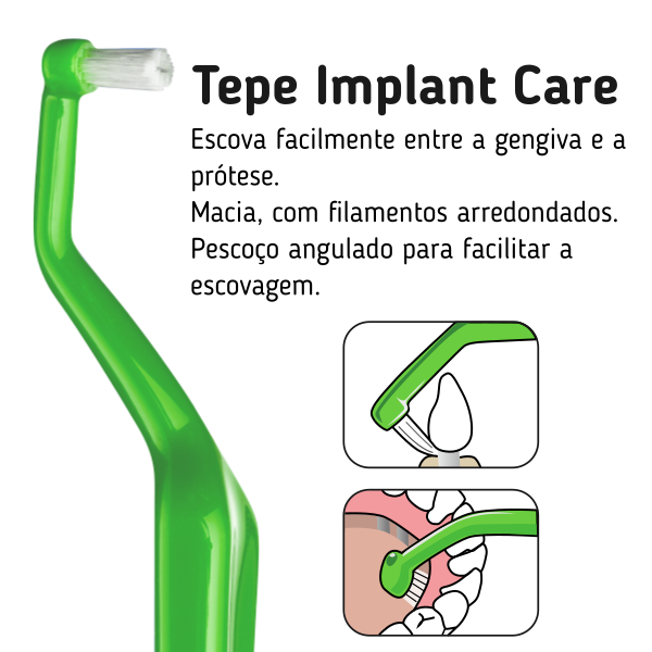 Tepe Universal Implant Care 14 pcs