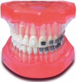 Orthodontiemodel mix