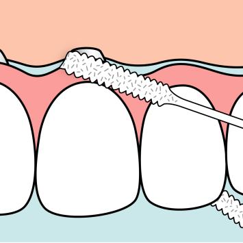 Bridge & Implant floss 1x30 st